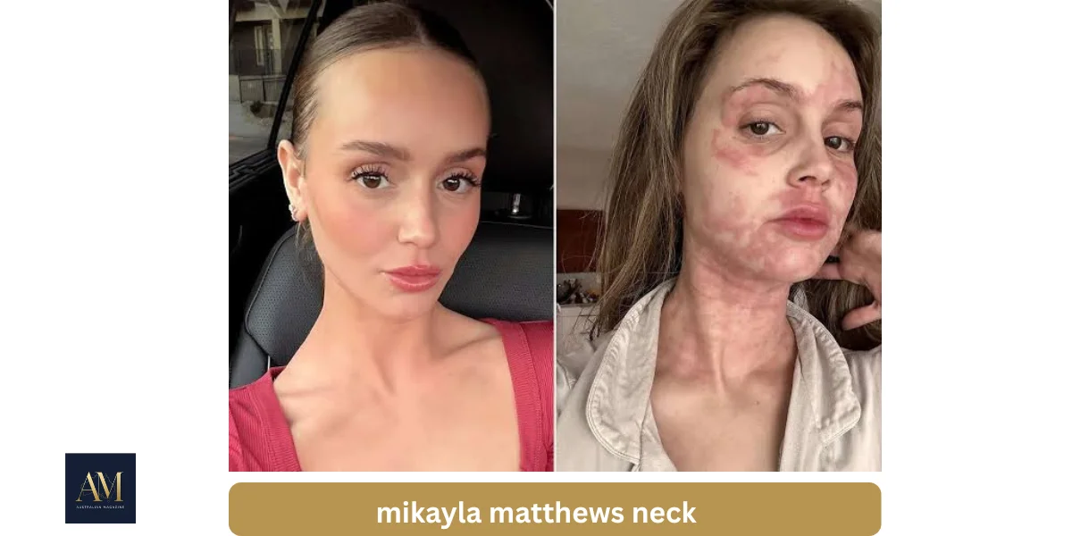 mikayla matthews neck
